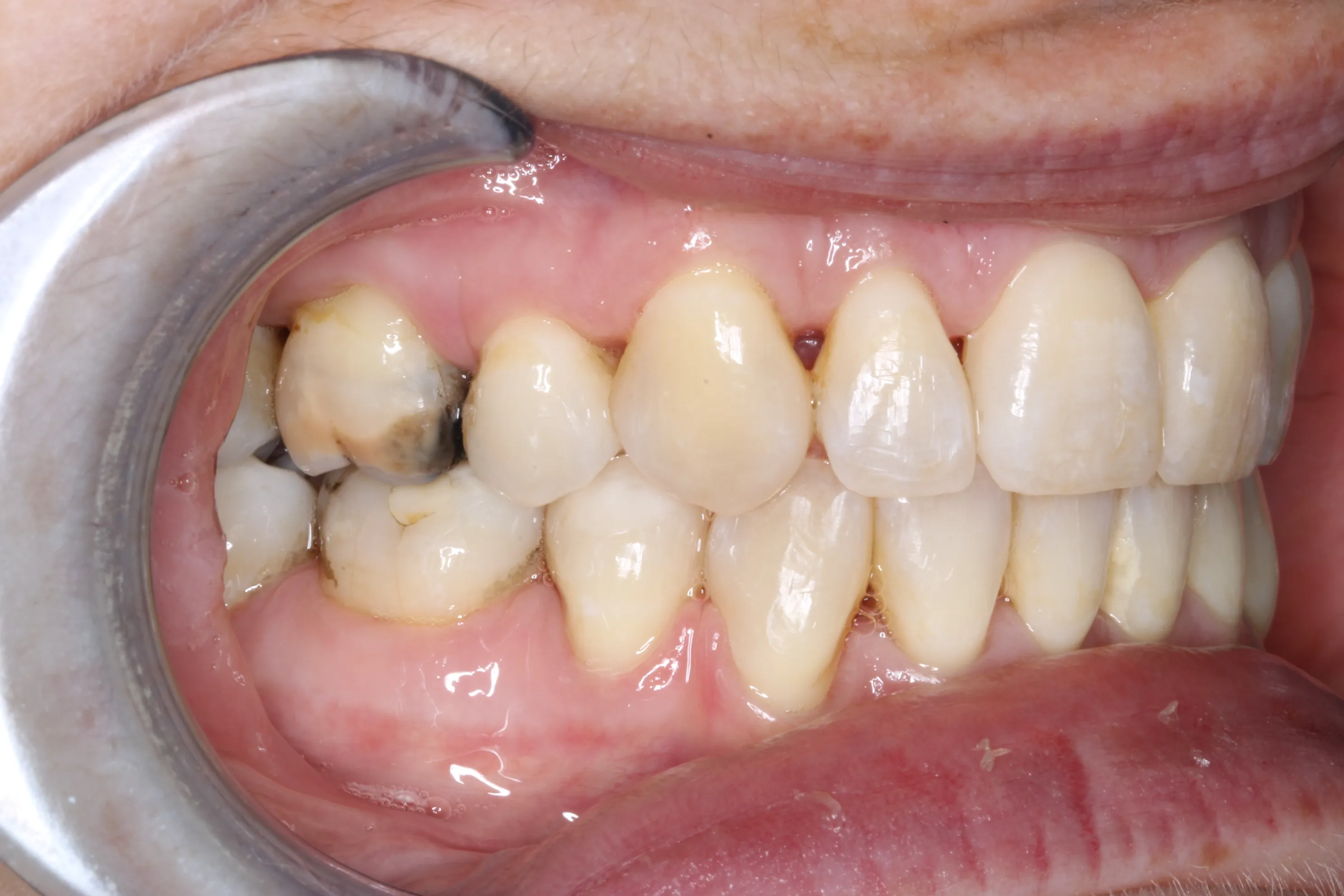 smile-gallery gallery